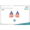 Digitus CAT6 U-UTP Patch Cable 0,25m Blue DK-1617-0025/B