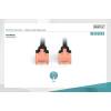 Digitus CAT6 U-UTP Patch Cable 1m Black DK-1617-010/BL