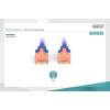 Digitus CAT6 U-UTP Patch Cable 3m Blue DK-1617-030/B